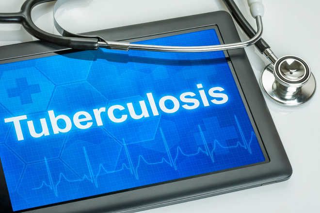 Health Dept to make use of AI to detect TB