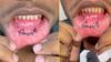 Man gets his girlfriend’s name tattooed inside his lower lip; Internet is not amused