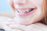 Having difficulty with your dental braces? Now AI to come to your rescue