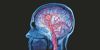 Neurological conditions now leading cause of ill health and disability globally: Lancet study