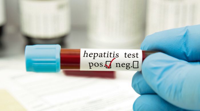 India 2nd only to China in viral hepatitis cases: WHO
