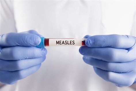 Global measles cases see 88 per cent jump in 2023: World Health Organization