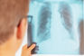 IHLD partners with Krafton India to detect active tuberculosis cases in UP, Uttarakhand