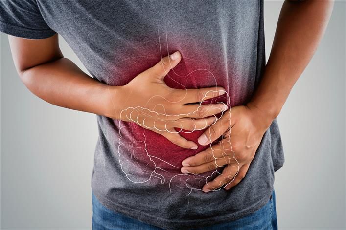 Inflammatory bowel disease (IBD) is often misdiagnosed