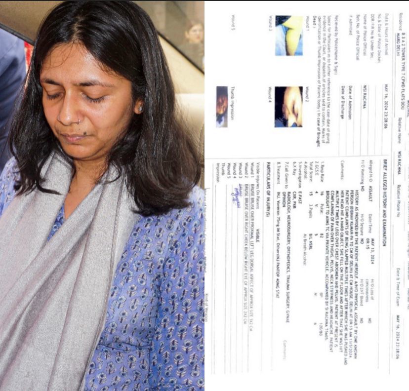 Swati Maliwal's AIIMS medical report shows bruises over her left leg and her right cheek