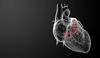 How Is Medinol's Xemed TAVR System Changing the Game in Heart Valve Replacement?